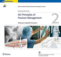 Image of AO Principles of Fracture Management (Vol-2)
