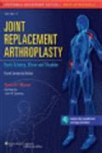 Image of Joint Replacement Arthroplasty: Basic Science, Elbow & Shoulder